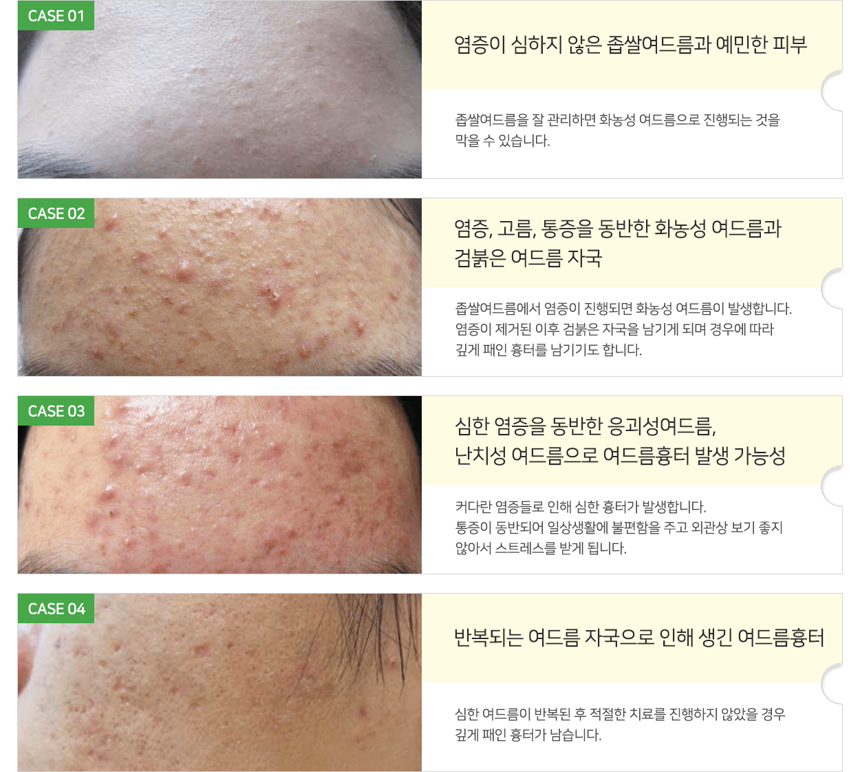 컨텐츠 이미지