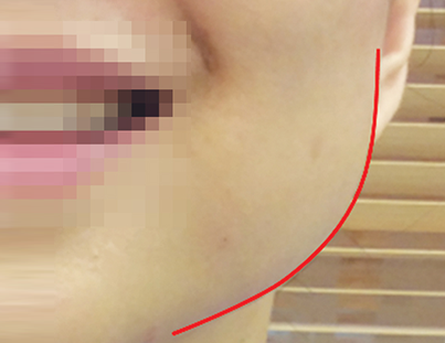 컨텐츠 이미지