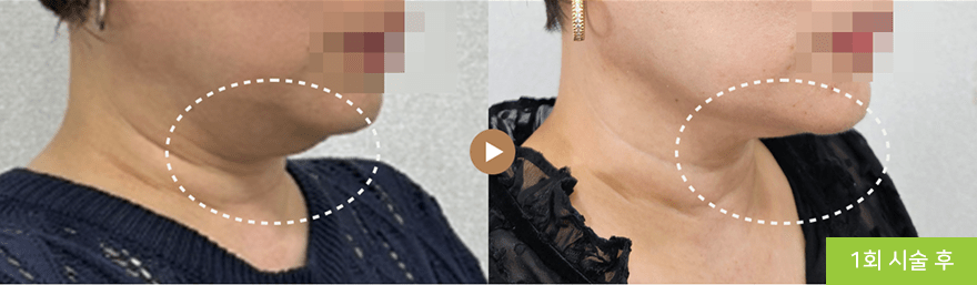 컨텐츠 이미지