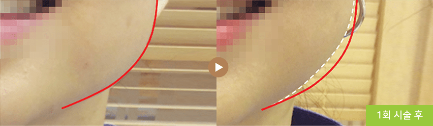 컨텐츠 이미지